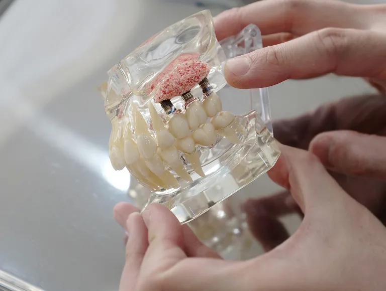 Bone Grafting and Preparatory Procedures