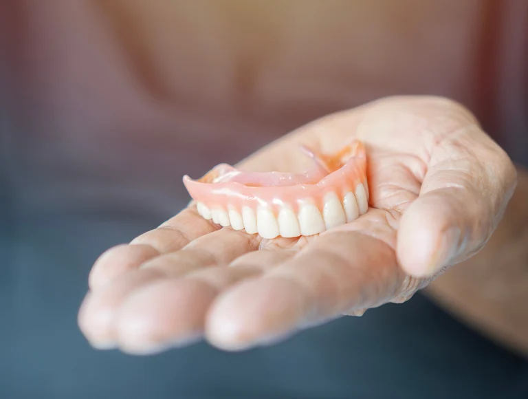 Full-Arch Implants vs. Traditional Dentures