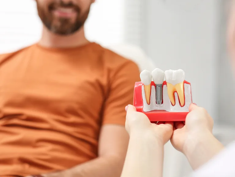 How Single Tooth Implants Compare to Other Options